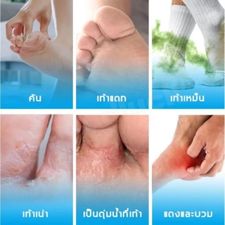 ครีมทาเท้าต้านอาการคันและเชื้อรา ควบคุมกลิ่นเท้าได้อย่างมีประสิทธิภาพ บรรเทาอาการคัน ป้องกันกลิ่น และเหมาะสำหรับเท้าเหม็