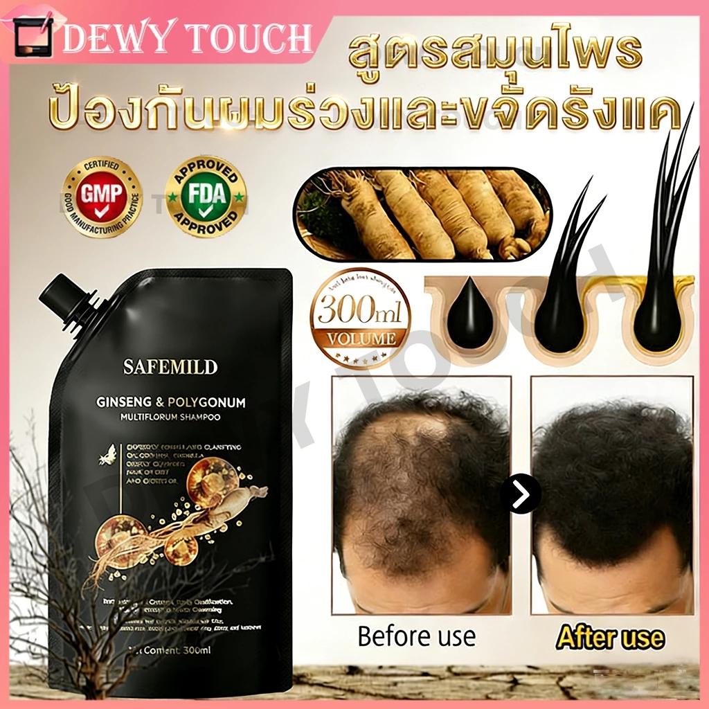 🔥ซื้อ 1 แถม 2🔥SAFEMILD แชมพูป้องกันผมร่วง แชมพูแก้ผมหงอก ลดผมร่วง ผมหนาดกดำ เร่งผมยาว บำรุงเส้นผม