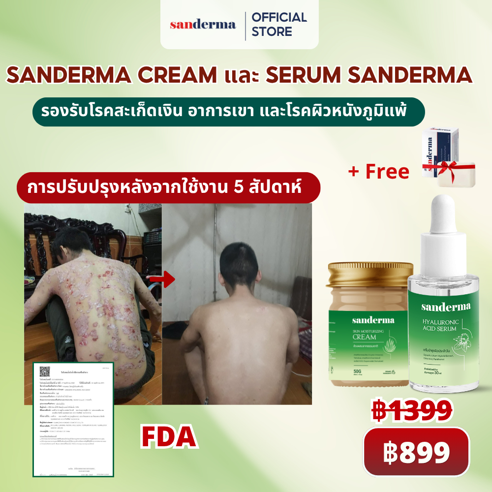 COMBO Sandermar Cream Serum Sanderma เซ็ตบำรุงผิว ลดอาการคัน ผิวชุ่มชื้น ฟื้นฟูผิวแพ้ง่าย