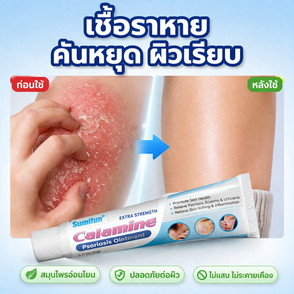 ครีมแก้คัน ครีมลดอาการคัน สะเก็ดเงินครีม โรคผิวหนัง เกลื้อน กลาก คัน สมุนไพร แก้คันเรื้อรัง คันในร่มผ้า