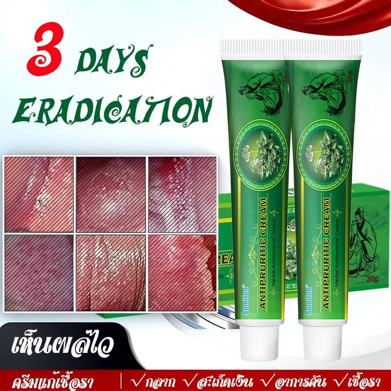 ครีมแก้คันผิว ลดผื่นคัน บรรเทาอาการคัน ฆ่าเชื้อรา ฟื้นฟูผิว เห็นผลไว 20G