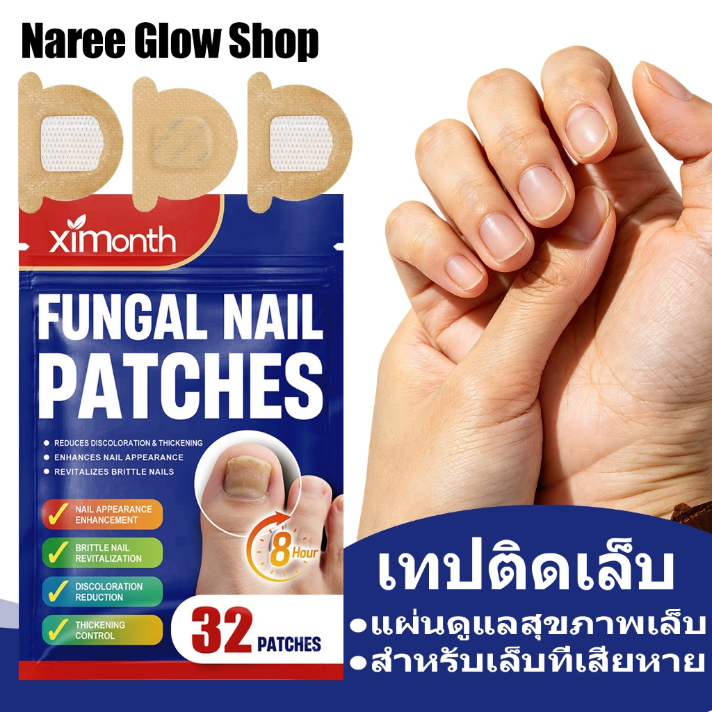Ximonth แผ่นแปะเล็บเชื้อราสําหรับเล็บเท้า 32Pcs แผ่นดูแลสุขภาพเล็บ สําหรับเล็บที่เสียหาย ดูแลและซ่อมแซมเล็บเท้า