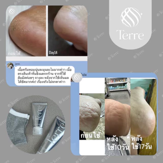 Terre Ultra Repair Cream เทอร์เร่อัลตรารีแพร์ครีม สูตรเข้มข้น สำหรับเท้า มือ ศอก เข่า 7 กรัม