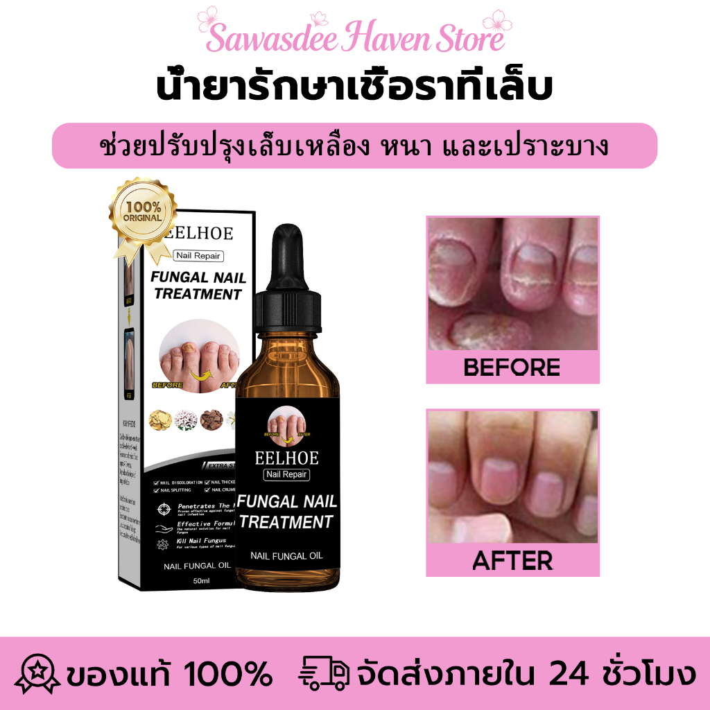 EELHOE น้ำยารักษาเชื้อราที่เล็บ น้ำยาซ่อมแซมเล็บเหลือง น้ำยารักษาเล็บ ซ่อมแซมเล็บแตก 50ml