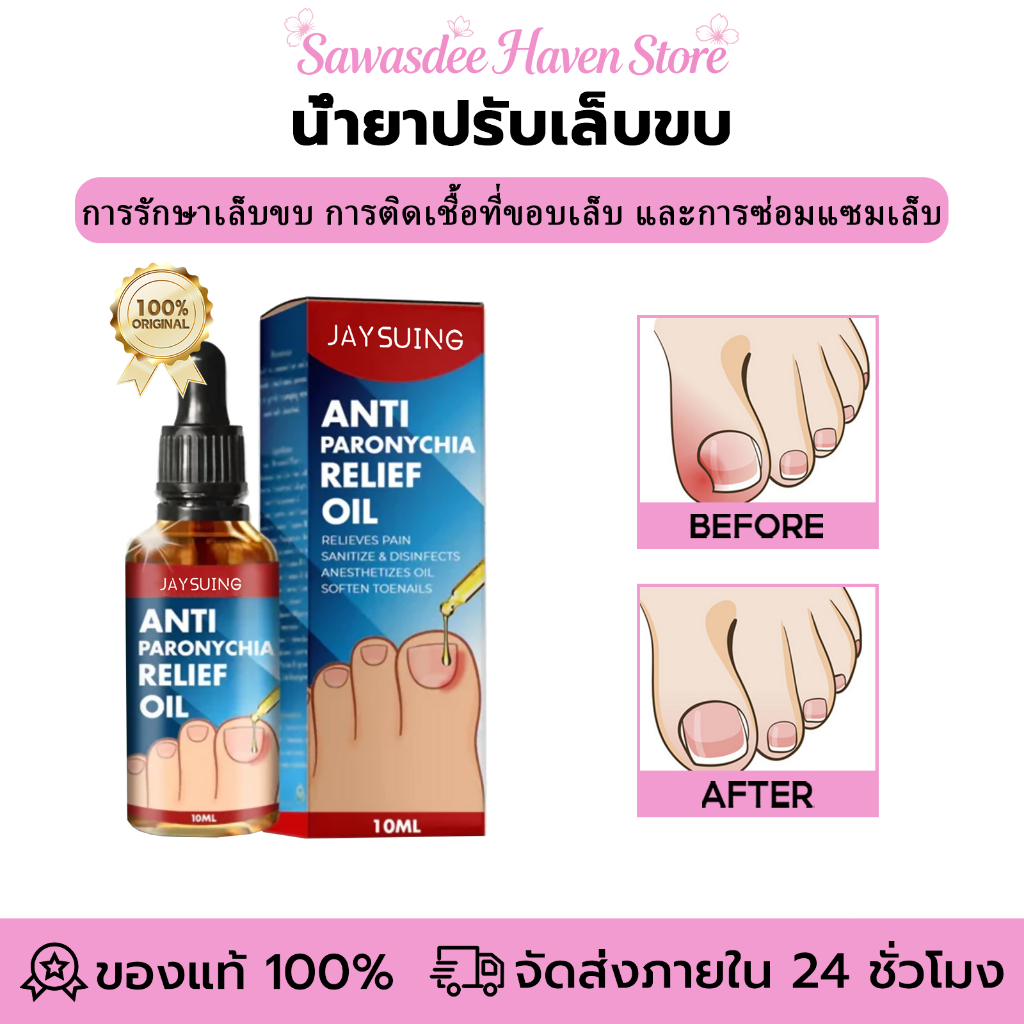 Jaysuing น้ํายาปรับเล็บขบ ปรับเล็บขบ โรคติดเชื้อที่ขอบเล็บ เล็บแตก ซ่อมแซมเล็บ รักษาเชื้อราที่เล็บ เล็บอักเสบ