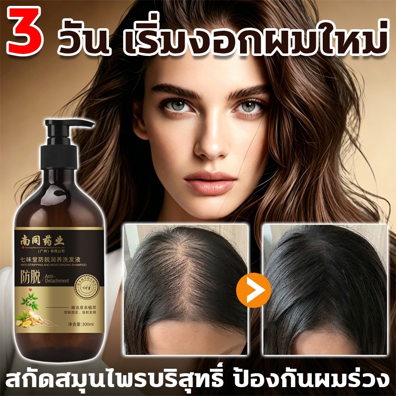 แชมพูป้องกันผมร่วง ล้างครั้งเดียว หยุดผมร่วงได้เลย แชมพูขิง แชมพูแก้ผมร่วง 3 วัน เริ่มงอกผมใหม่ แชมพูปลูกผม