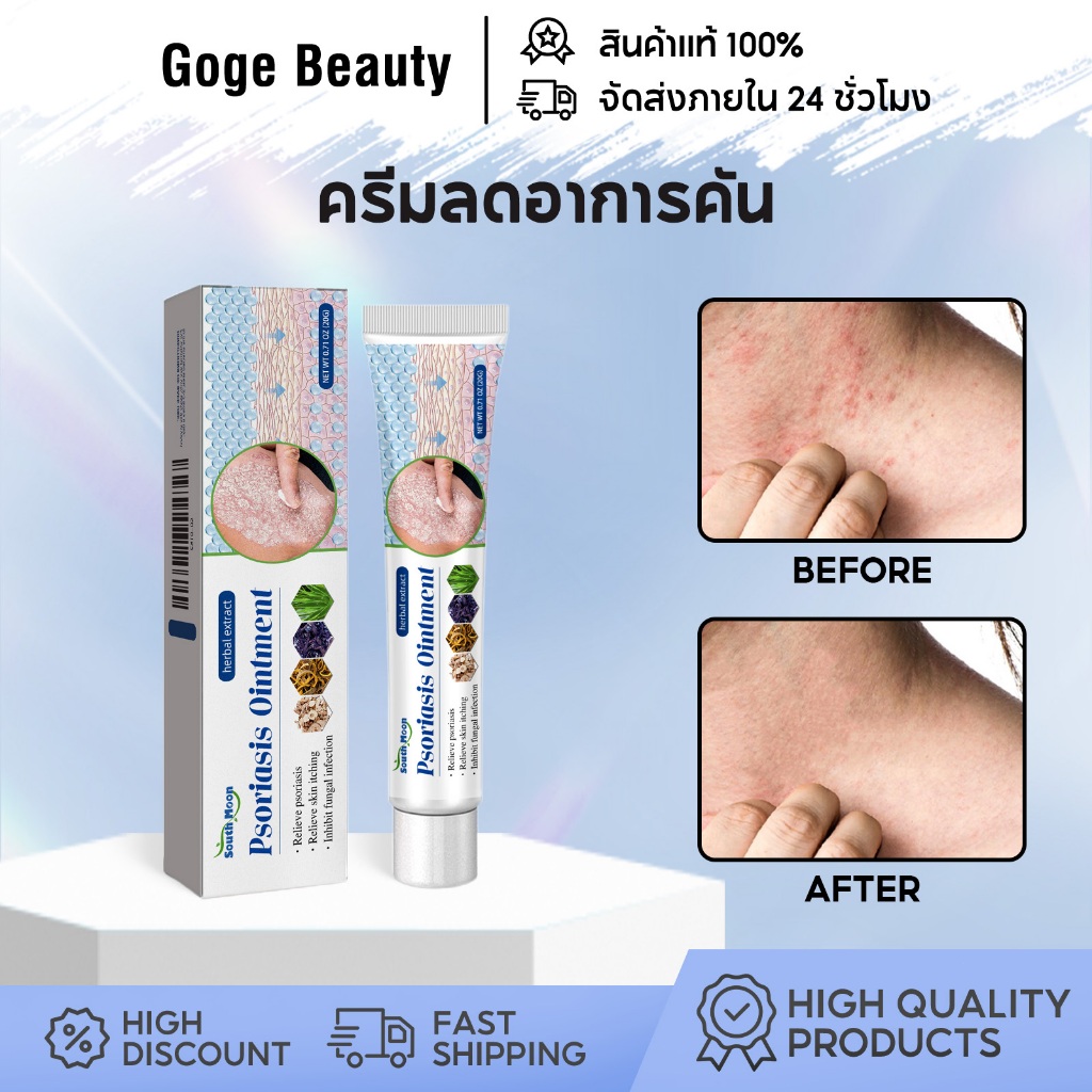 South Moon ครีมลดอาการคัน บาล์มบำรุงผิว สูตรสมุนไพร ลดอาการคันผิวหนัง ใช้ได้กับผื่นแห้ง คัน ผื่นคัน