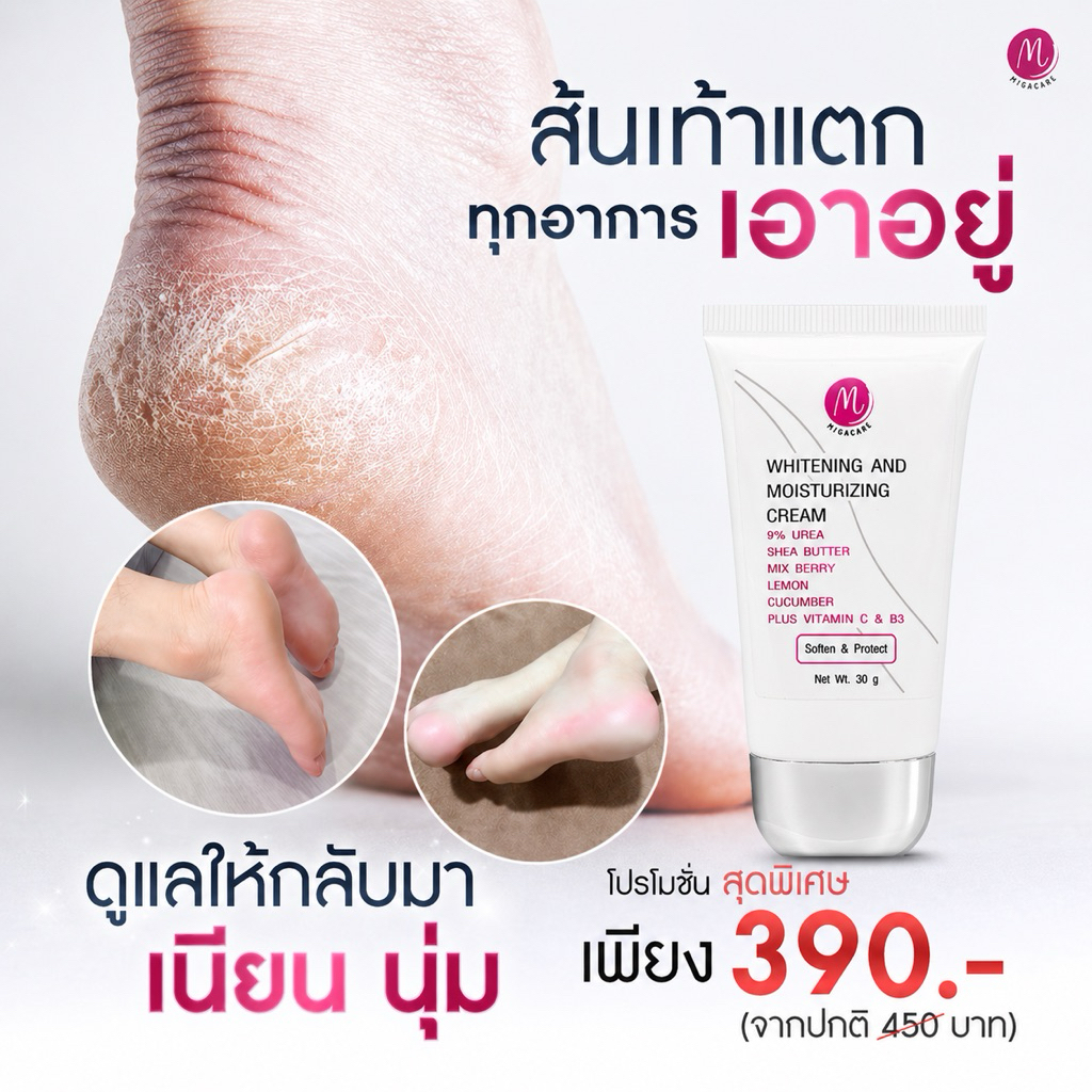 ครีมทาเท้าmigacare( ฃนาด30กรัม)บำรุงมือเท้าจบในหลอดเดียว