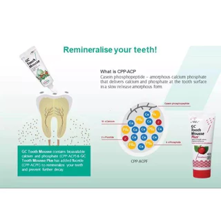 (หมดอายุ 2028+) GC Tooth Mousse Plus™ ครีมบำรุงฟัน แคลเซียมชีวภาพ + ฟลูออไรด์ ซ่อมแซมผิวฟัน ลดอาการเสียวฟัน ปกป้องฟันผุ