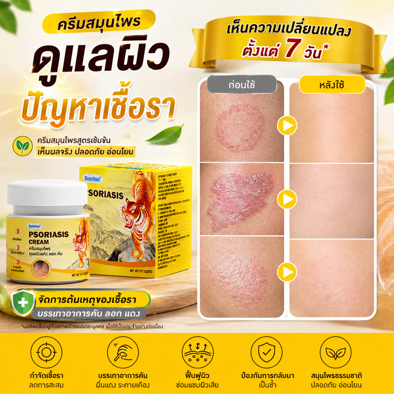 🔥ฟื้นฟูผิว🔥 ครีมสมุนไพรแก้คัน ครีมดูแลผิวเฉพาะจุด ช่วยลดความไม่สบายผิว ฟื้นฟูผิว ซึมไว ใช้ง่าย