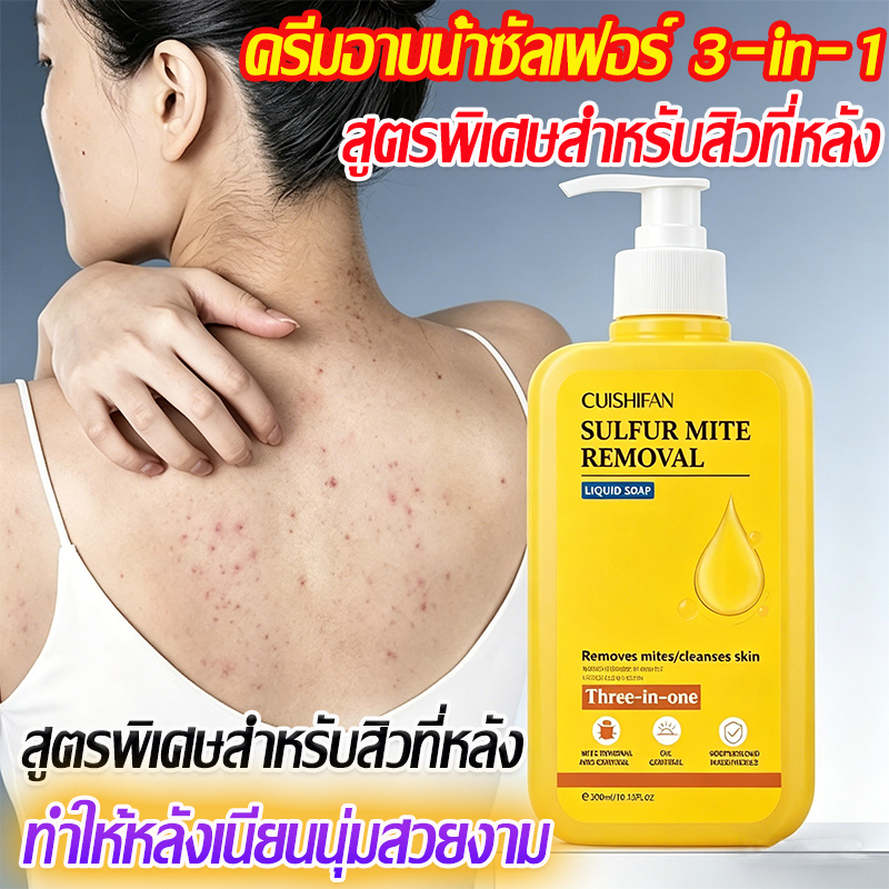 โลชั่นอาบน้ำส่วนผสมกำมะถัน กำจัดสิวหลังหลัง จุดแดง ตุ่มบนผิว ยับยั้งอาการคัน กำจัดไรฝุ่น ใช้ได้ทั้งผู้ชายและผู้หญิง สบู่