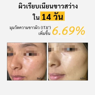 Spring Letter Toner Pad แผ่นเช็ดหน้า VC ขนาดพกพา ลดจุดด่างดำ ขาวใส ละลายฝ้า กระ ฝ้า จุดด่างดำ จางลง สำหรับผิวบอบบาง