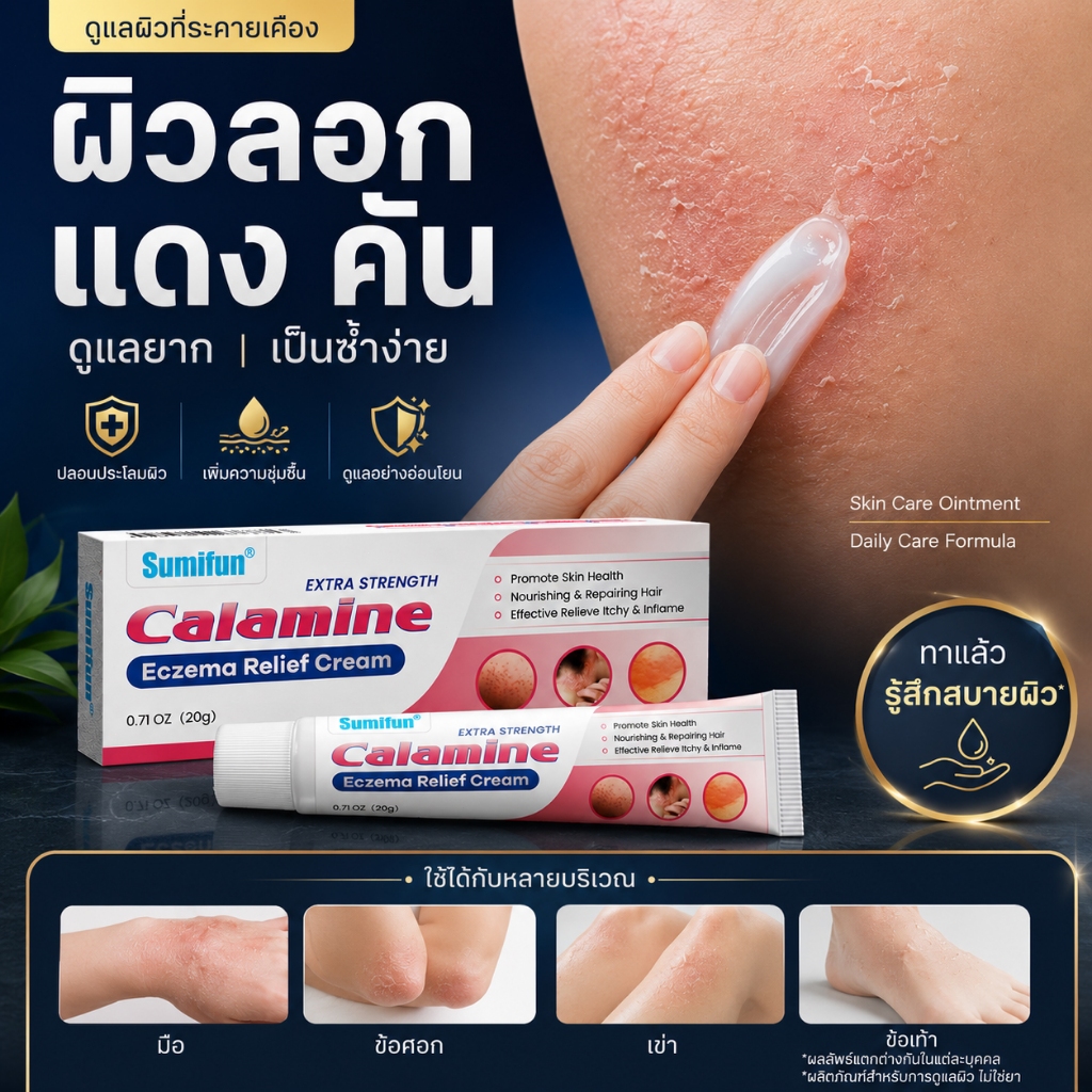 Calamine Skin Care Cream ครีมบำรุงผิว ลดความแห้ง ผิวลอก คัน ดูแลผิวระคายเคือง สูตรอ่อนโยน ใช้ได้ทุกวัน สำหรับมือ เท้า แล