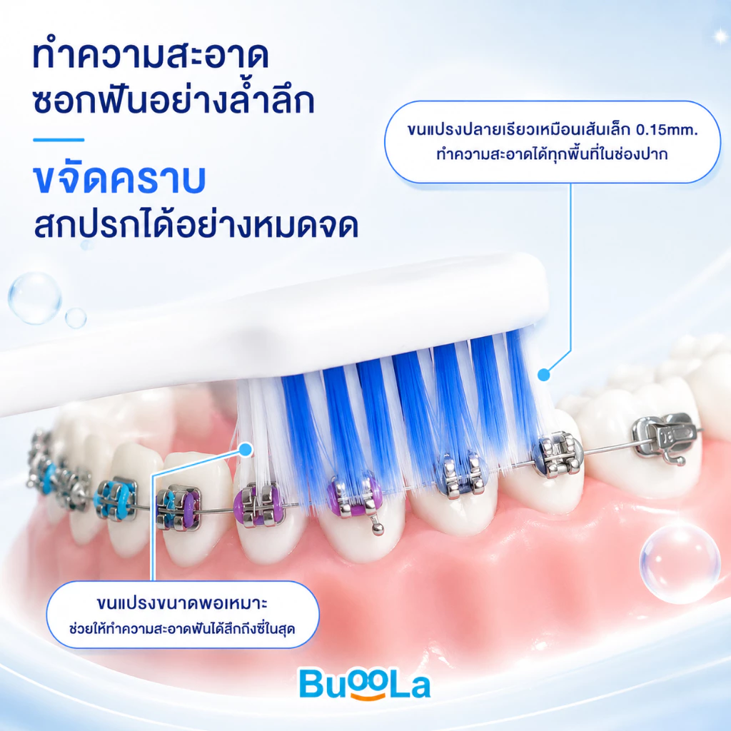 Buoola แปรงสีฟันคนจัดฟัน ขนนุ่มสองชั้น พร้อมแปรงขัดซอกฟัน 4ชิ้น thumbnail 7