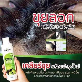 แชมพูอัลตร้ามายด์ แก้คัน รังแค เชื้อราหนังศีรษะ สเก็ตเงิน บำรุงผมให้ดกดำ