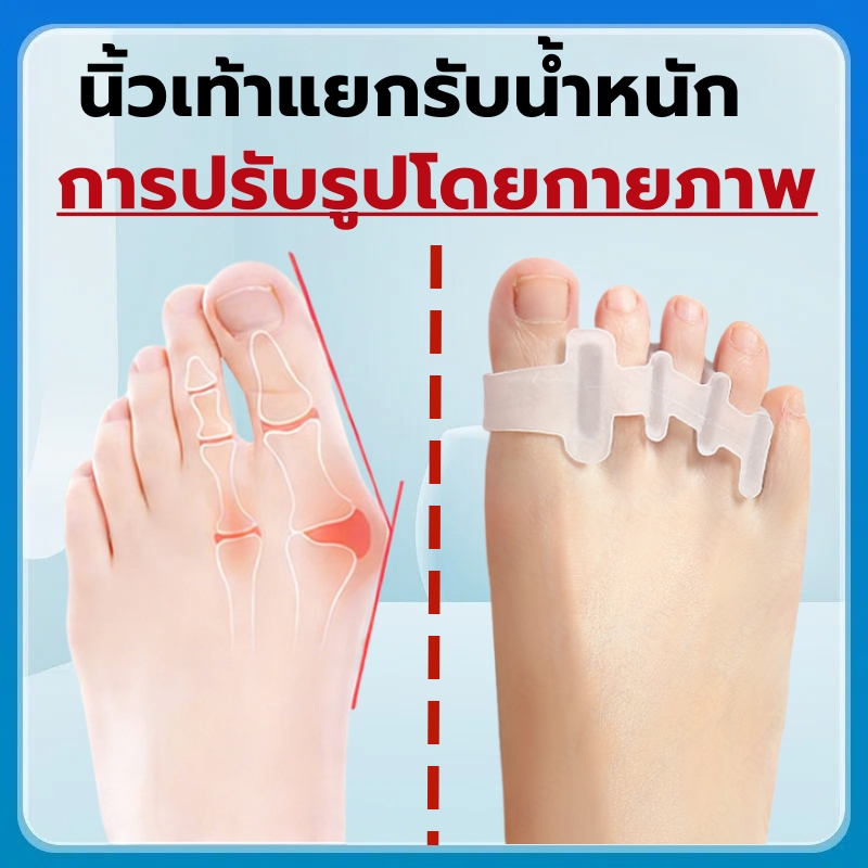 ซิลิโคนแยกนิ้วเท้า 5 ช่อง จัดเรียงนิ้วเท้า ลดนิ้วเบียด นิ้วเท้ากอดซ้อน นุ่มยืดหยุ่น ใส่สบาย สวมรองเท้าเดินนอกบ้านได้