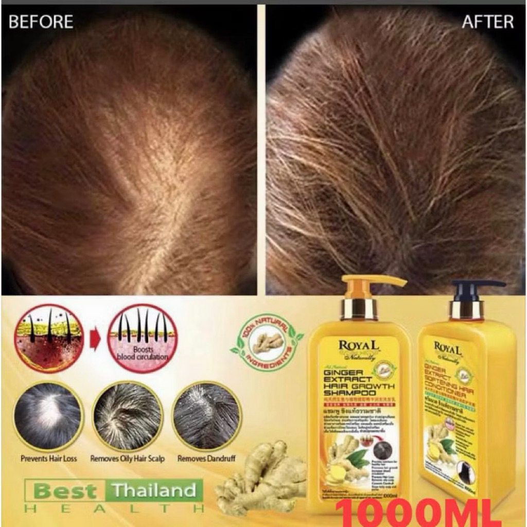 Royal Naturally 1000ml แชมพูขิงแท้1ขวดแก้ผมร่วงรังแคคันหนังศรีษะหนังศรีษะมันและแห้งเสียแก้ทุกปัญหาของหนังศรีษะและเส้นผม – โปรปัง