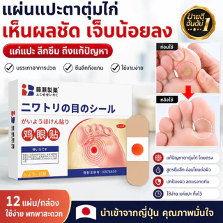 แผ่นแปะตาตุ่มไก่ ฟื้นฟูเร็ว เจ็บน้อย ใช้ง่าย ซึมลึกถึงแกน 12 แผ่น/กล่อง นำเข้าจากญี่ปุ่น