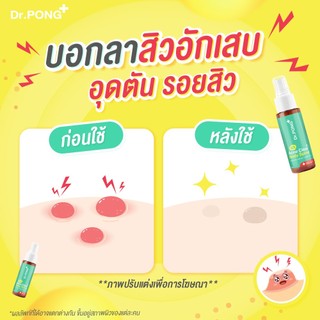 Dr.PONG B3 Acne Clear Body Spray สเปรย์ฉีดที่หลัง และลำตัว Niacinamide - BHA - ZincPCA
