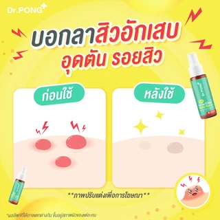 Dr.PONG B3 Acne Clear Body Spray สเปรย์ฉีดที่หลัง และลำตัว Niacinamide - BHA - ZincPCA