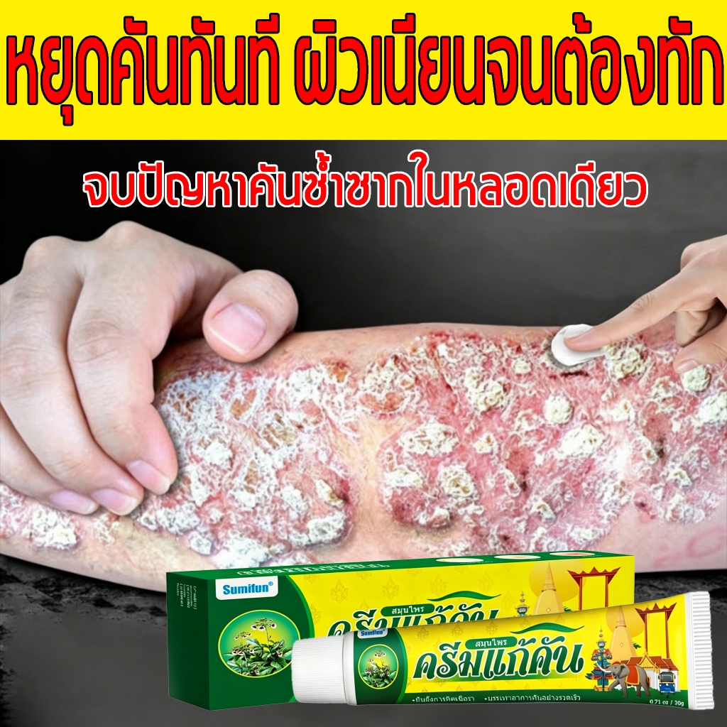 ครีมทาเกลื้อน สูตรสมุนไพร อ่อนโยน ซึมเร็ว ลดอาการคัน บำรุงผิวเสีย ให้ผิวเรียบเนียน ใช้ได้ทุกส่วนของร่างกาย ใช้งานง่าย