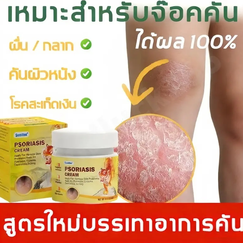 【 ซื้อ 1 แถม 1】ครีมบำรุงผิวแห้ง Sumifin สูตรอ่อนโยน ช่วยปลอบประโลมผิวแห้งแตก ลอกเป็นขุย เติมความชุ่มชื้น ใช้ได้ทุกวัน