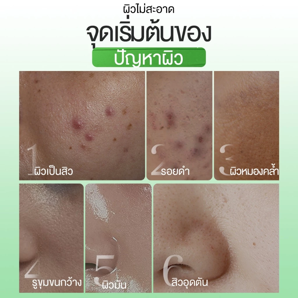 SKINTIFIC Clay Mask Stick Mugwort สคินทิฟฟิค มัควอร์ธ แอคเน่ เคลย์ สติ้กซ์  มาร์คหน้า มาร์คโคลน ลดสิวหน้าใส ลด สิวเสี้ยน thumbnail 3