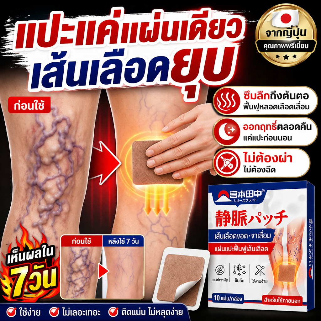 Varicose Vein Treatment Patch แผ่นแปะเส้นเลือดขอด ขาสวย ลบเส้นเลือดขอด กลับคืนสุขภาพเท้า 10ชิ้น