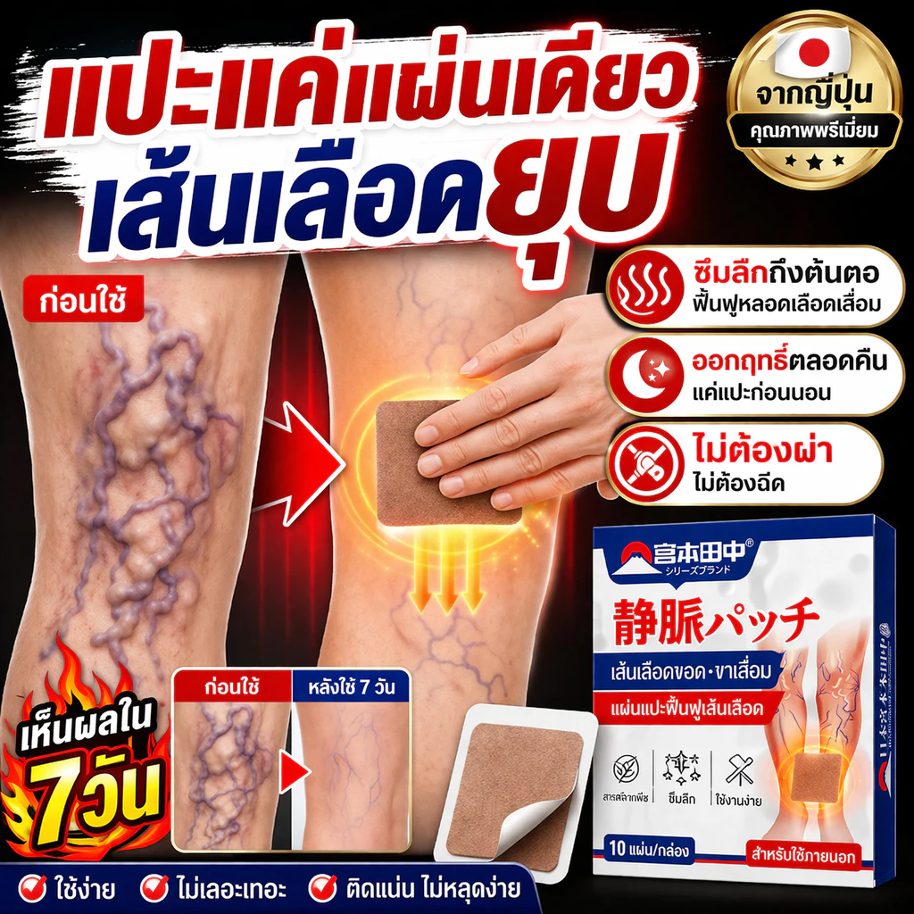 Varicose Vein Treatment Patch แผ่นแปะเส้นเลือดขอด ขาสวย ลบเส้นเลือดขอด กลับคืนสุขภาพเท้า 10ชิ้น