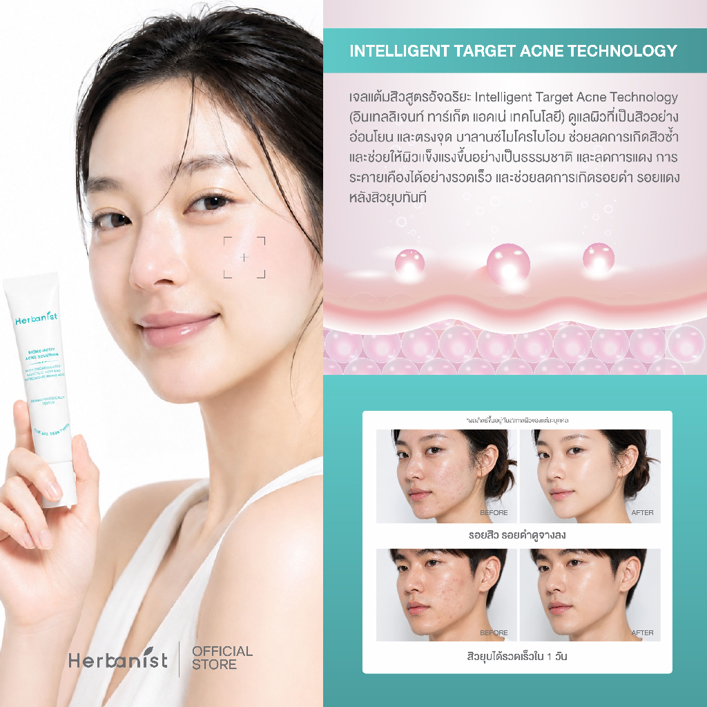 Herbanist جل حب الشباب Biome-Activ ‏Acne Solution — صورة 5