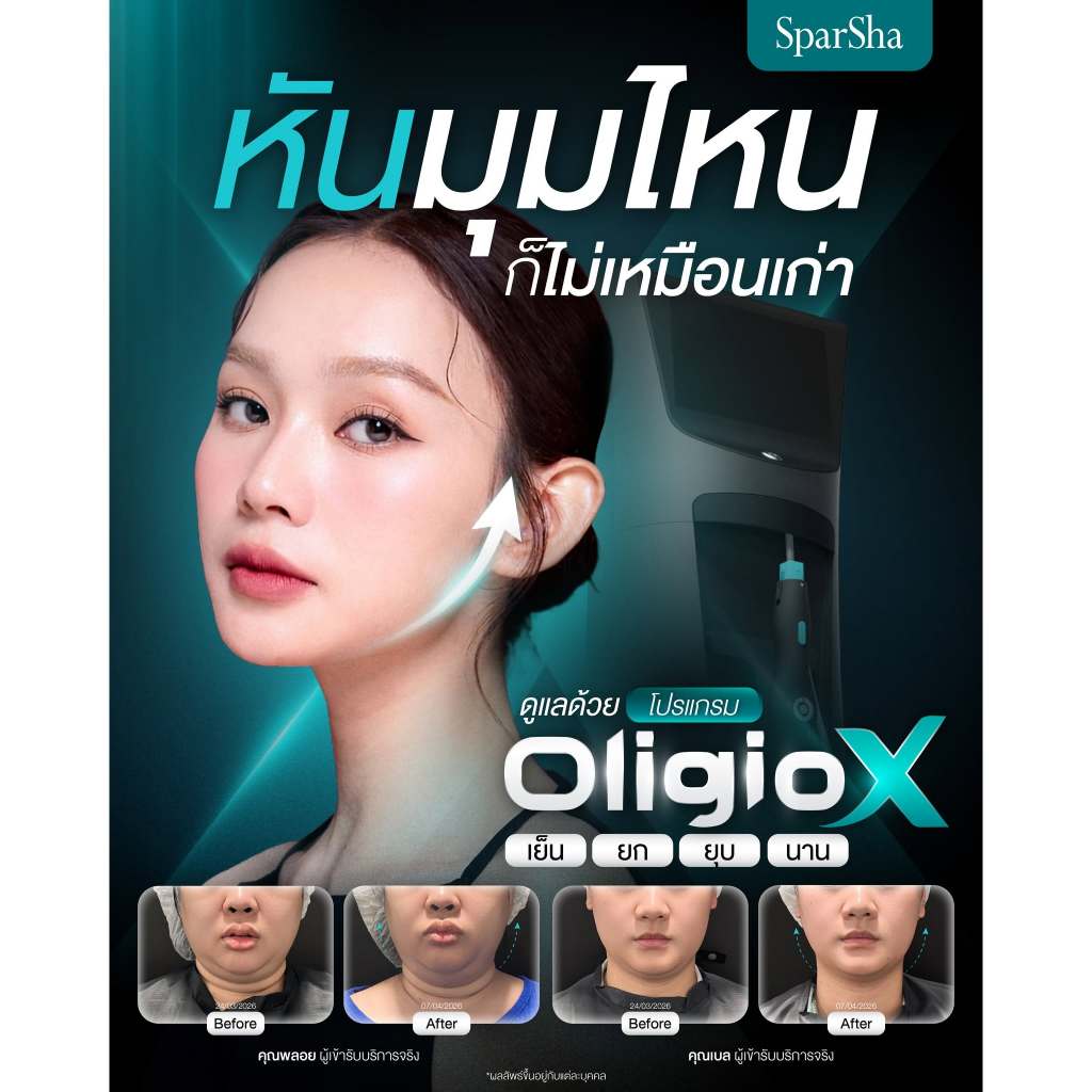 SparSha โปรแกรม Oligio X ยกกระชับผิวหน้า กรุณาจองล่วงหน้าอย่างน้อย 3 วันน (เข้ารับบริการที่คลินิก)