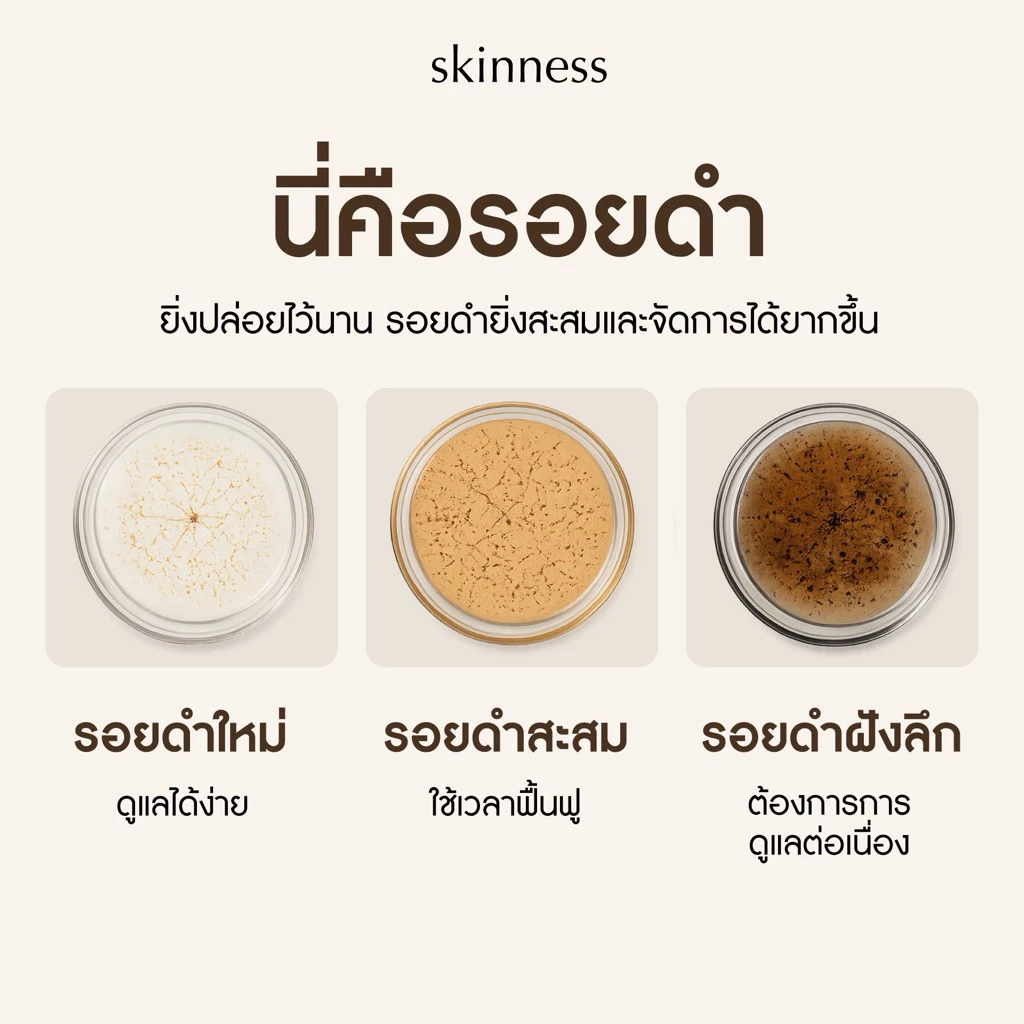 Skinness Brightening Dark Spot Body Lotion ครีมลดรอยบำรุงผิวกาย thumbnail 4