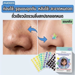 แผ่นแปะสิว 36แผ่น คุ้มกว่า เนียนสนิท มองไม่เห็น สิวหายเร็ว ไม่ทิ้งรอย ปกปิดสิว ราคาถูก พร้อมส่ง