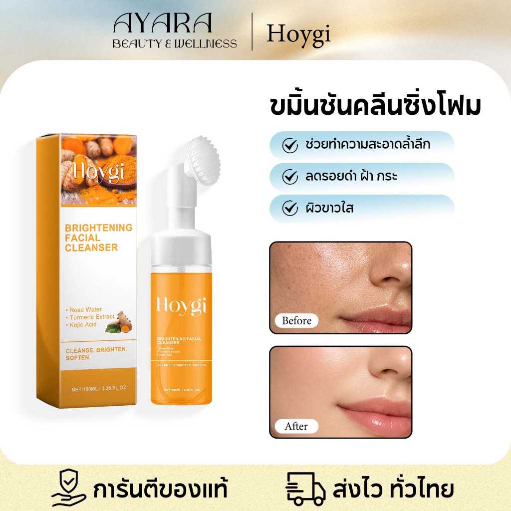 Hoygi โฟมล้างหน้าขมิ้น ทำความสะอาดผิวหน้าอย่างล้ำลึก รอยแผลเป็นจากสิวจางลง ผิวชุ่มชื้นและกระจ่างใส