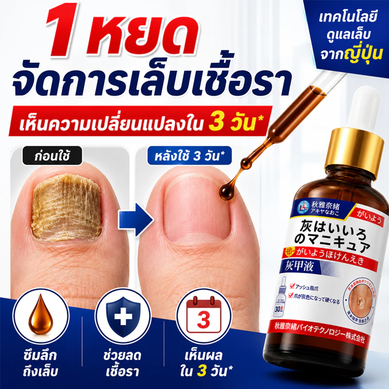 7 วัน ฆ่าเชื้อแบคทีเรีย เซรั่มบำรุงเล็บ รักษาเชื้อราเล็บ รักษาเล็บขบ ฆ่าเชื้อราที่เล็บ น้ำยาบำรุงเล็บ เชื้อราที่เล็บ