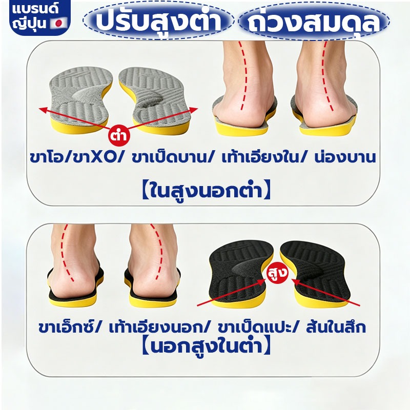 พื้นรองเท้าแก้ไขรูปขาทั้งหมด ไม่ว่าโอ/เอ็กซ์/XO ปรับแนวขาให้ตรงสวย