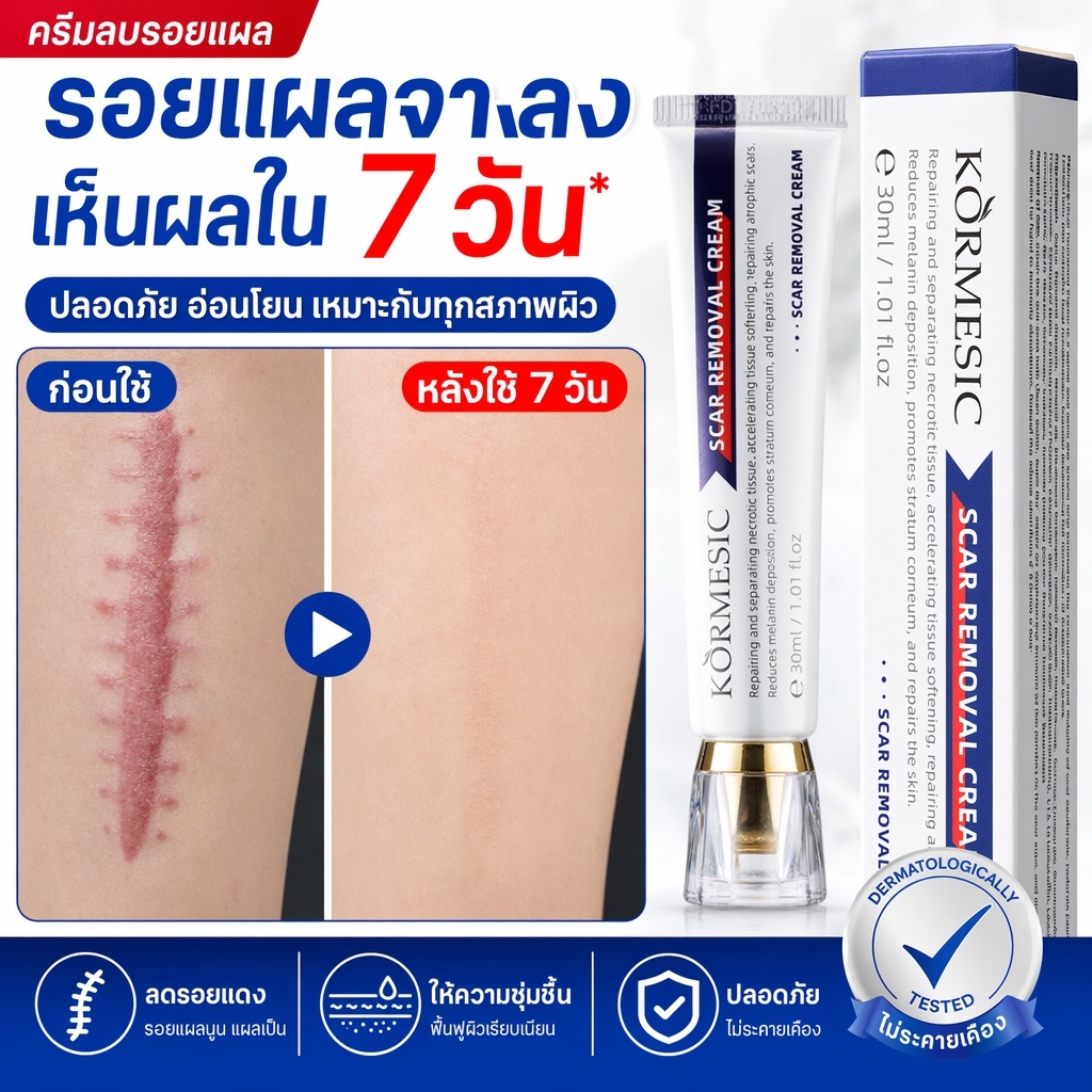 ยาทารอยแผลเป็น 30กรัม ลบรอยดำจากแผลไฟไหม้ รอยแตกลาย ให้รอยจางหายอย่างรวดเร็ว