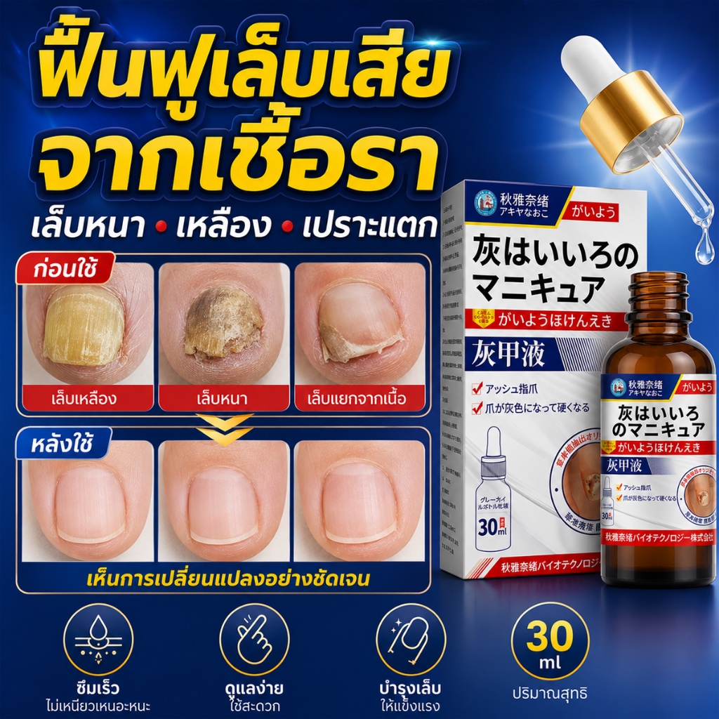 ส่งจากไทย บำรุงเล็บ กำจัดเชื้อราเล็บ เซรั่มบำรุงเล็บ