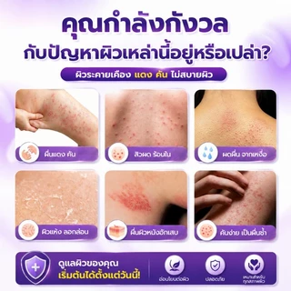 Kreain Nature ครีมรักษาผื่นผิวหนัง ครีมทาแก้แพ้ Natural Soothing Cream 20g
