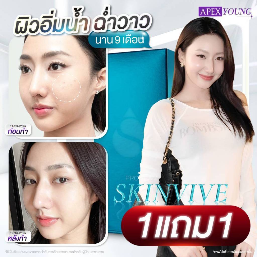 Voucher Apex โปรแกรม Skinvive 1 cc แถม 1 cc ได้ 2 cc ราคา 15000 บาท (1ท่าน1สิทธิ์)