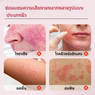 1 ครั้งเห็นผล Sumifun-ครีมบำรุงผิวและบรรเทาอาการระคายเคือง ครีมบรรเทา ช่วยยับยั้งเชื้อรา