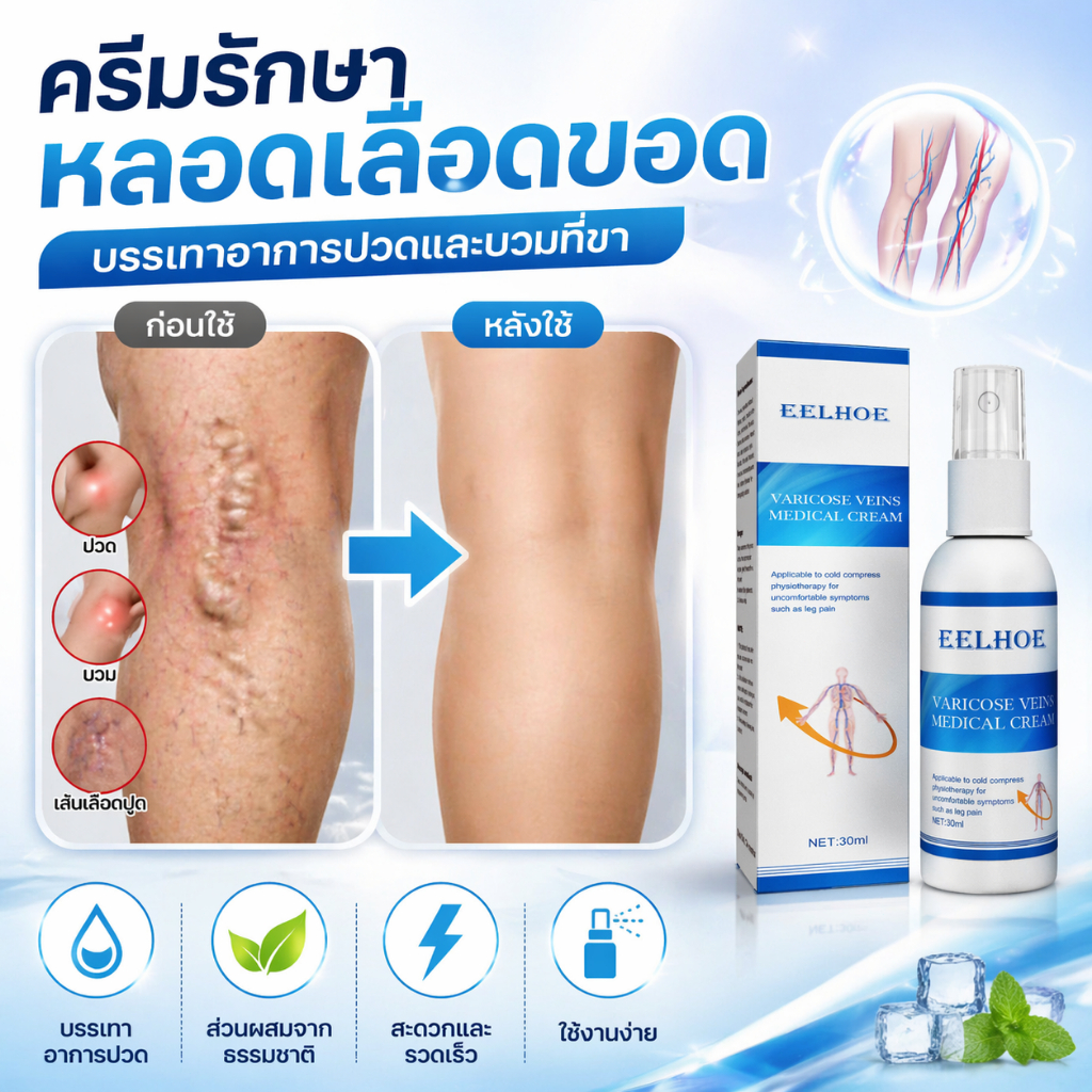 ครีมทาเส้นเลือดขอด บำรุงขาให้สวยงาม ลดเส้นเลือดขอด คืนความสบายให้เท้า สเปรย์เส้นเลือดขอด Varicose Vein Cream