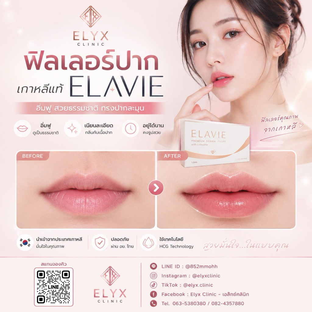 🇰🇷 โปรหน้าฝน | ฟิลเลอร์ปาก ELRAVIE 1 CC