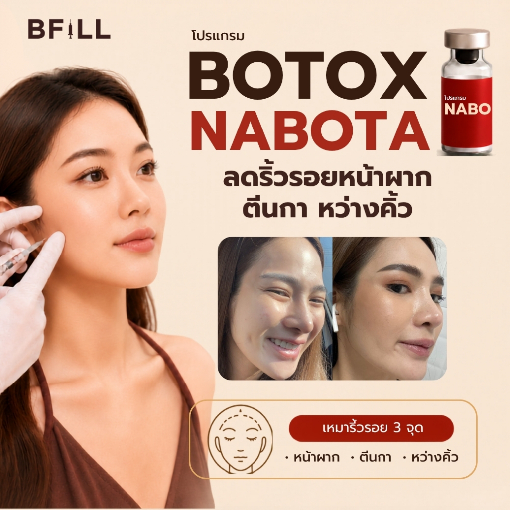 BFiLL โปรแกรม Botox Nabota โบท็อกซ์ริ้วรอย โบท็อกซ์หน้าผาก โบท็อกซ์หว่างคิ้ว โบท็อกซ์ตีนกา โบท็อกซ์ห