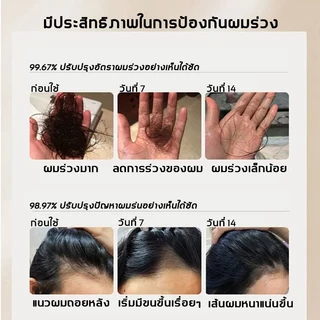 PEIMEI แชมพูแก้ผมร่วง แชมพูสมุนไพร แชมพูปลูกผม 250ml แชมพูปลูกผม แชมพูปลูกผมดก ยาสระผมเร่งผมยาว แชมพูขิง แชมพูบำรุงผม