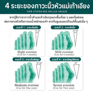 อุปกรณ์แก้ไขเท้า เจลไฟเบอร์สำหรับแก้ไขนิ้วเท้า ลดการเกเอียง ป้องกันนิ้วเบียด–นิ้วซ้อนเสียดสี บรรเทาอาการปวดเท้าได้