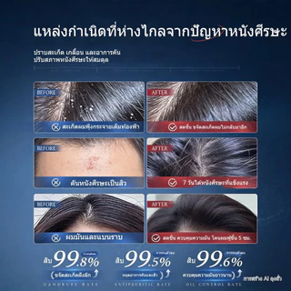 【SIMU แชมพู】ขจัดรังแค ลดอาการคัน ควบคุมความมันบนหนังศีรษะ 300ml