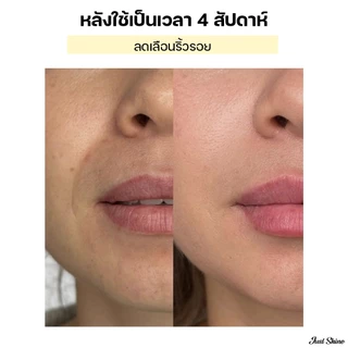 Set X2 Retinal ต่อต้านริ้วรอย ฟื้นฟูผิวให้ลดเลือนริ้วรอย ยกกระชับผิว เพิ่มความยืดหยุ่น