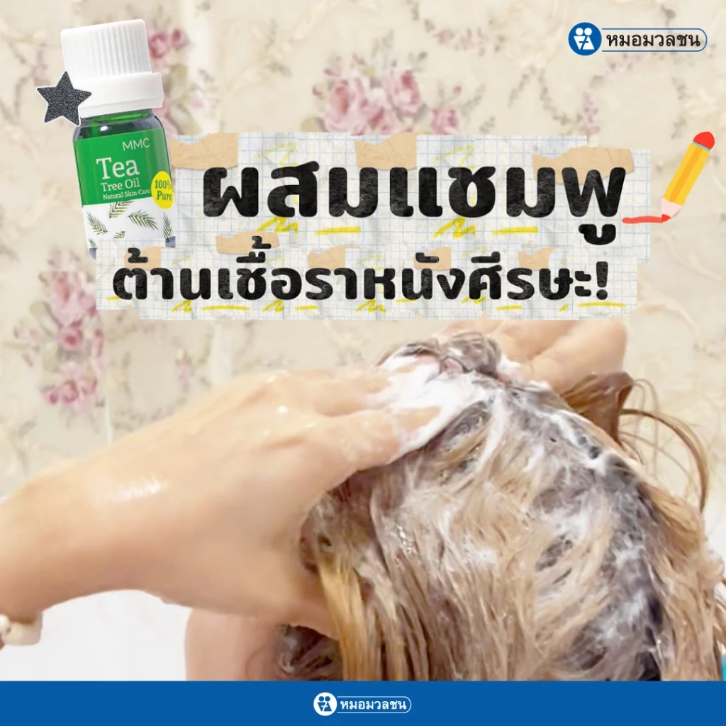 หมอมวลชน MMC Tea Tree Oil น้ำมันทีทรีบริสุทธิ์ thumbnail 6