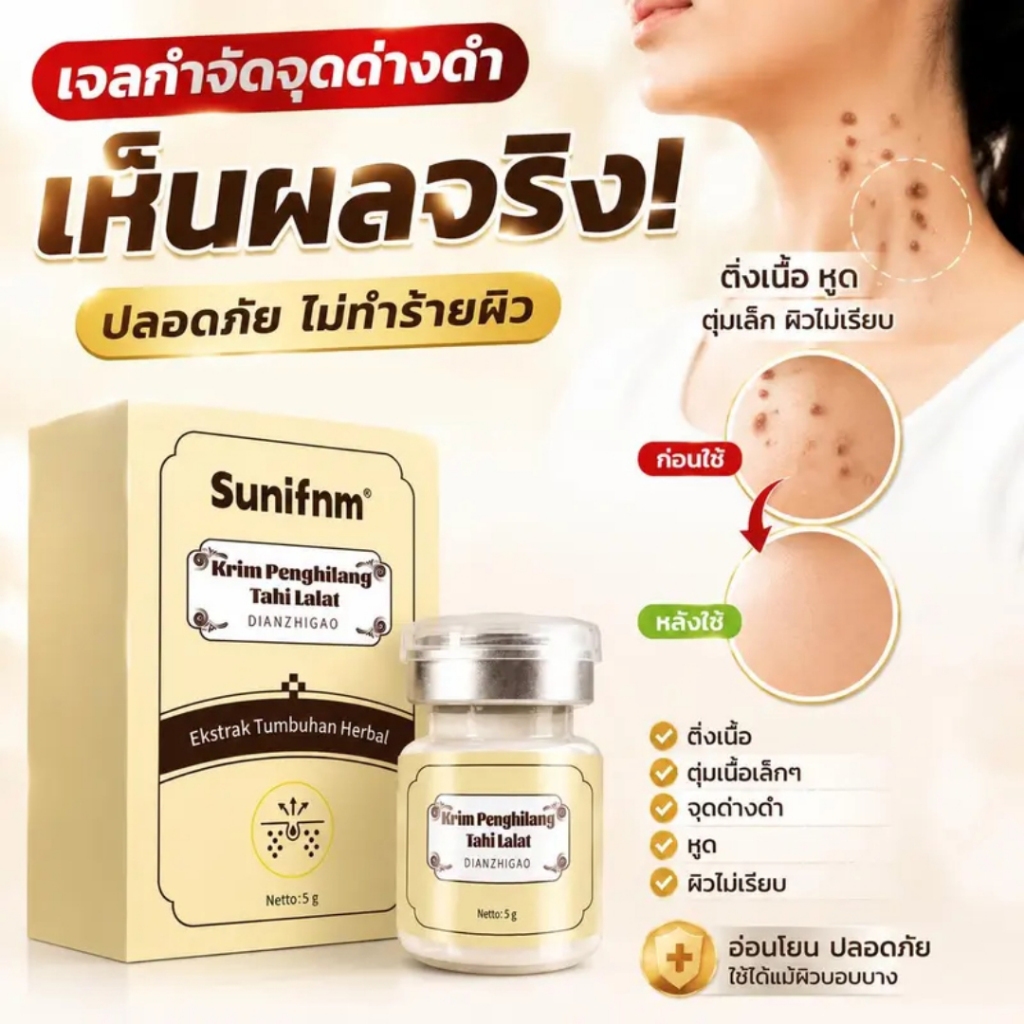 Sunifnm Flaw Spot Cream สูตรสมุนไพร ครีมกำจัดตั้งเนื้อ ต่มเล็กๆ บริเวณเสำคอ และติงเนื้อบริเวณรักแร้